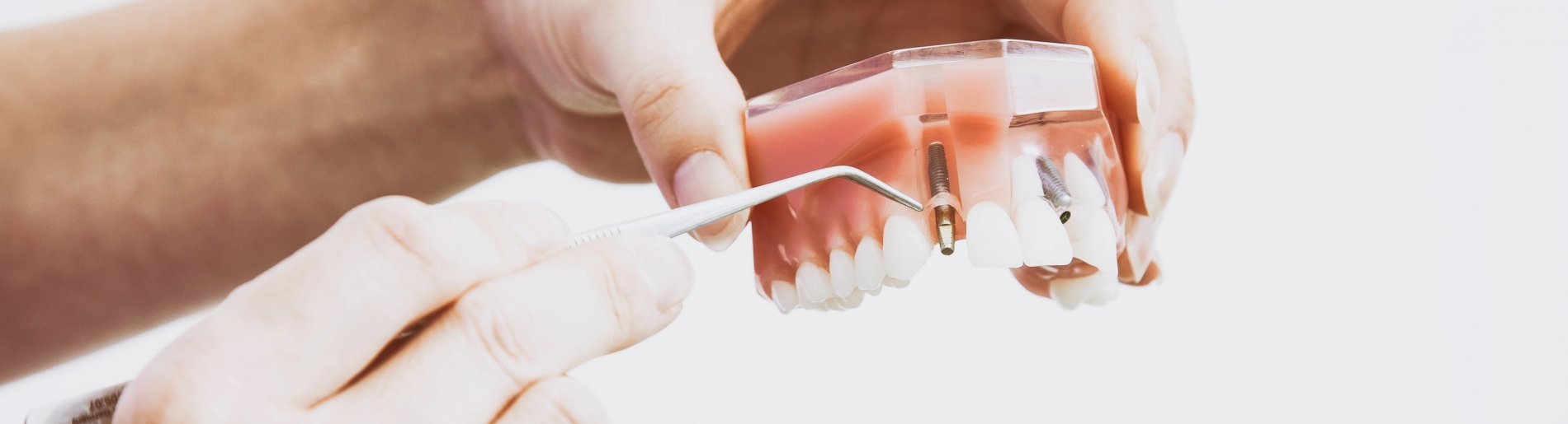 Dentures and Dental Implant Solutions